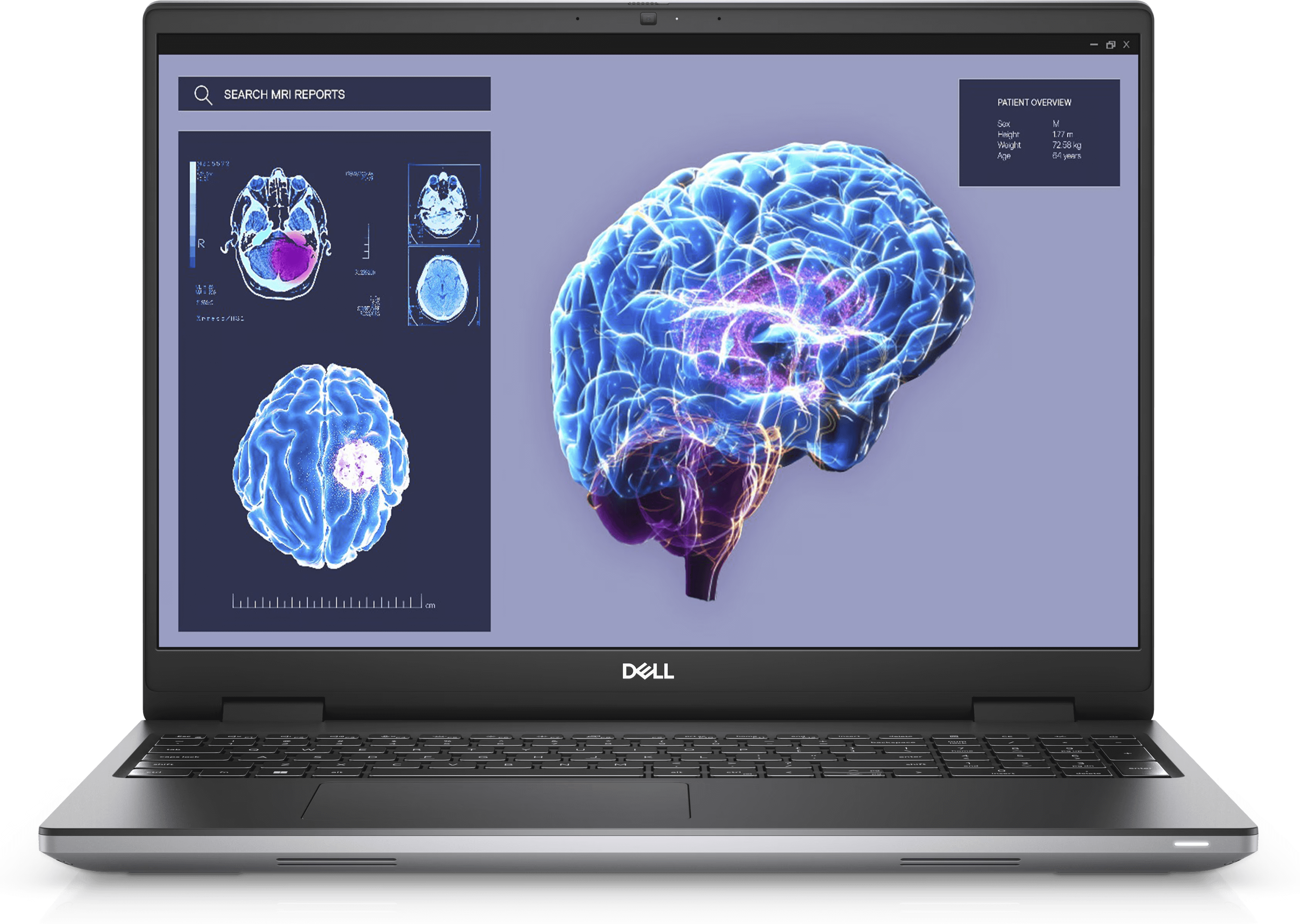 מחשב נייד Dell Precision 7680 PM-RD33-16181 דל