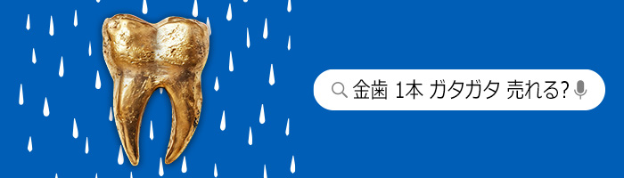 金歯は売れる？買取価格の決まり方と売却時の注意点を解説 ｜最新相場で高価買取なら『買取大吉』