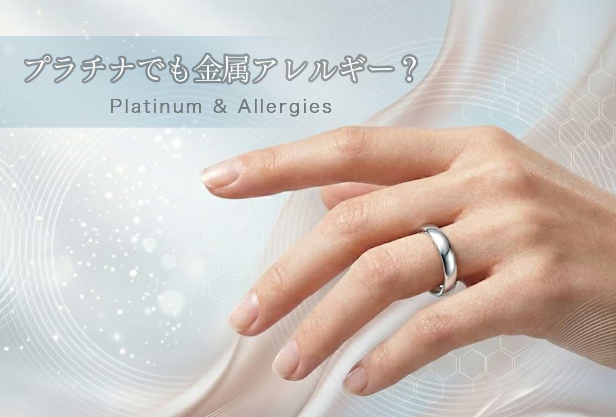 プラチナでも金属アレルギーは起きる？ 原因・純度別リスク・対処法を解説