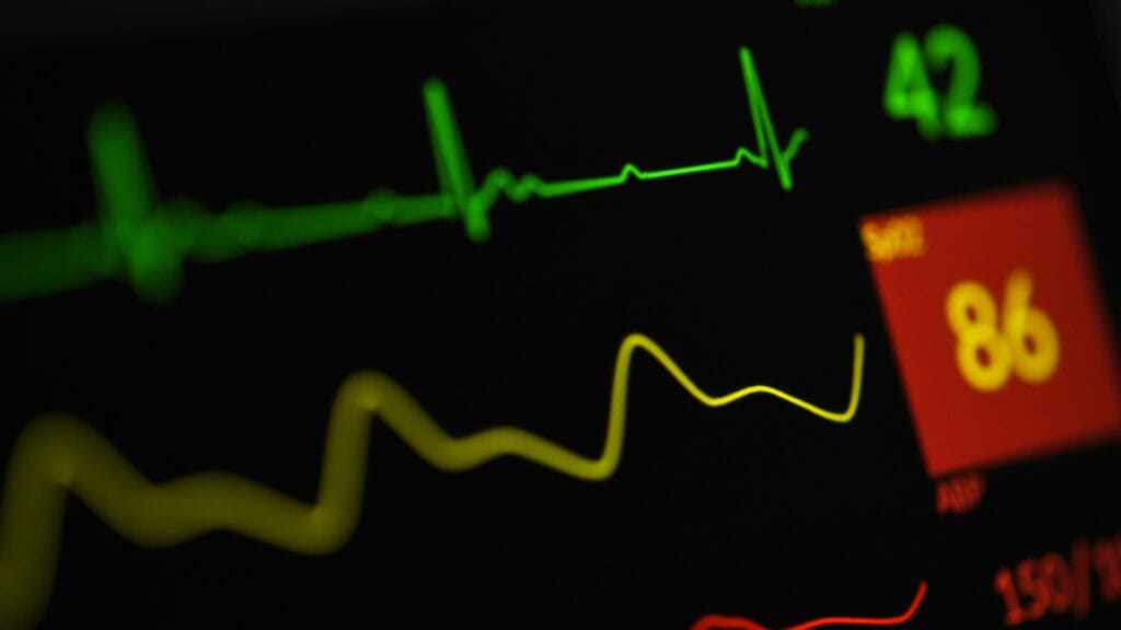 Heart rate variability