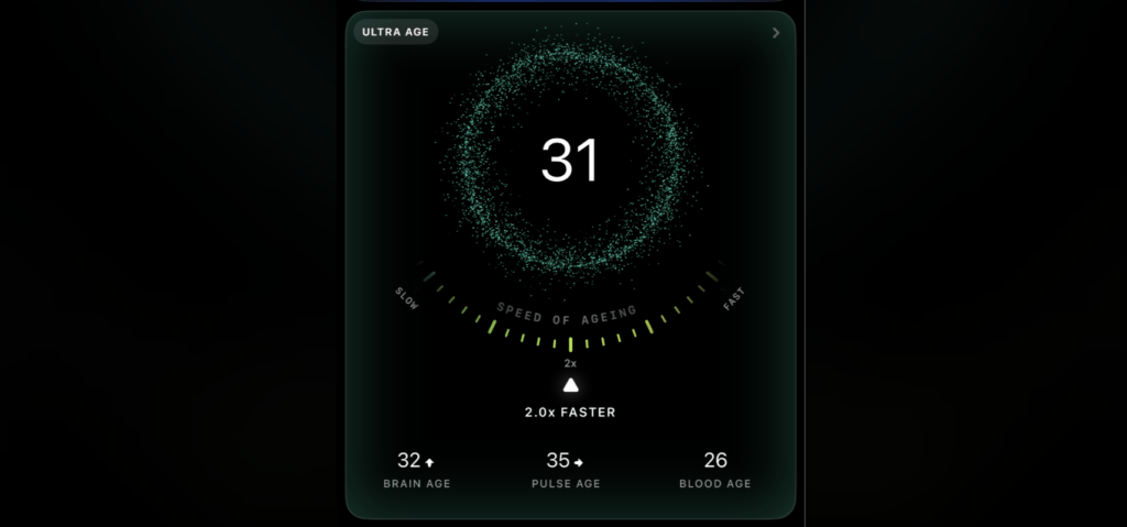 Speed of Aging