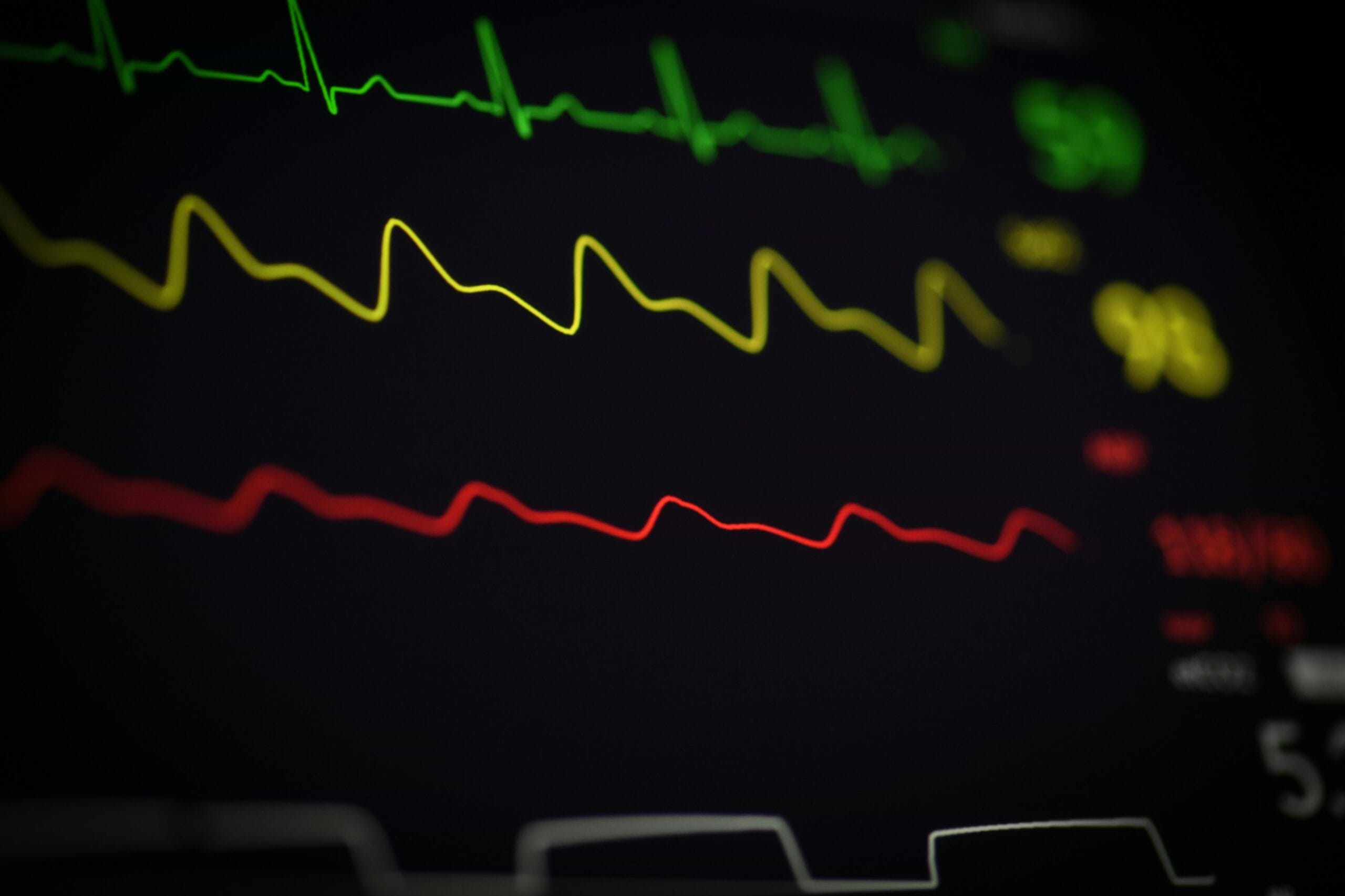 HRV by Age and Gender: What's Normal for Men vs Women