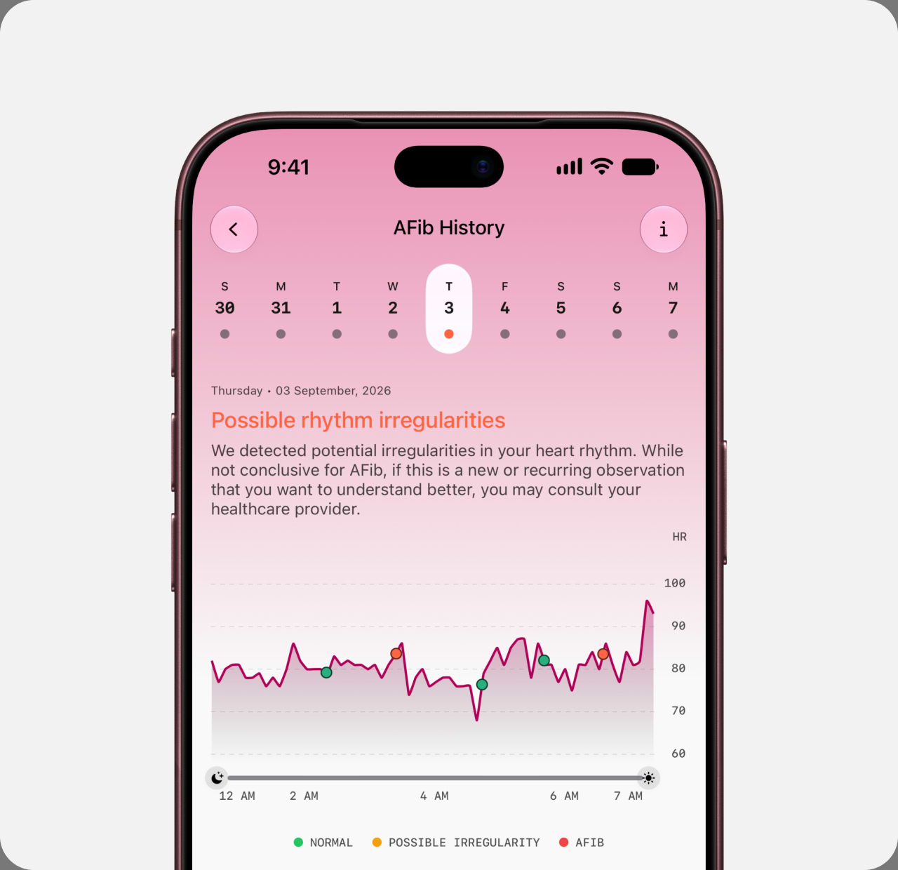 PowerPlugs in the Ultrahuman app: AFib Detection