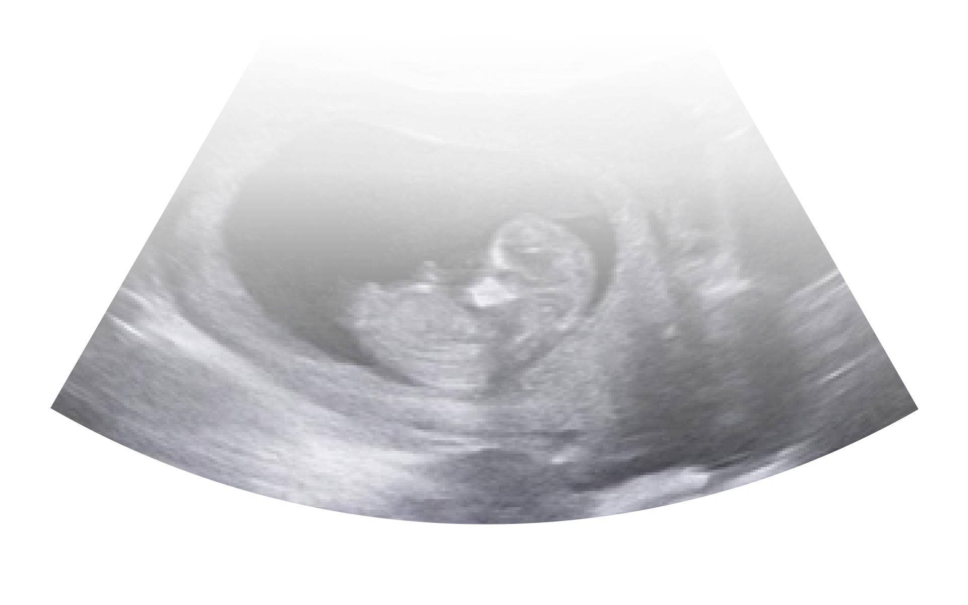 Pregnancy Insights