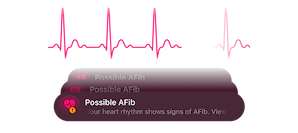 AFib Detection