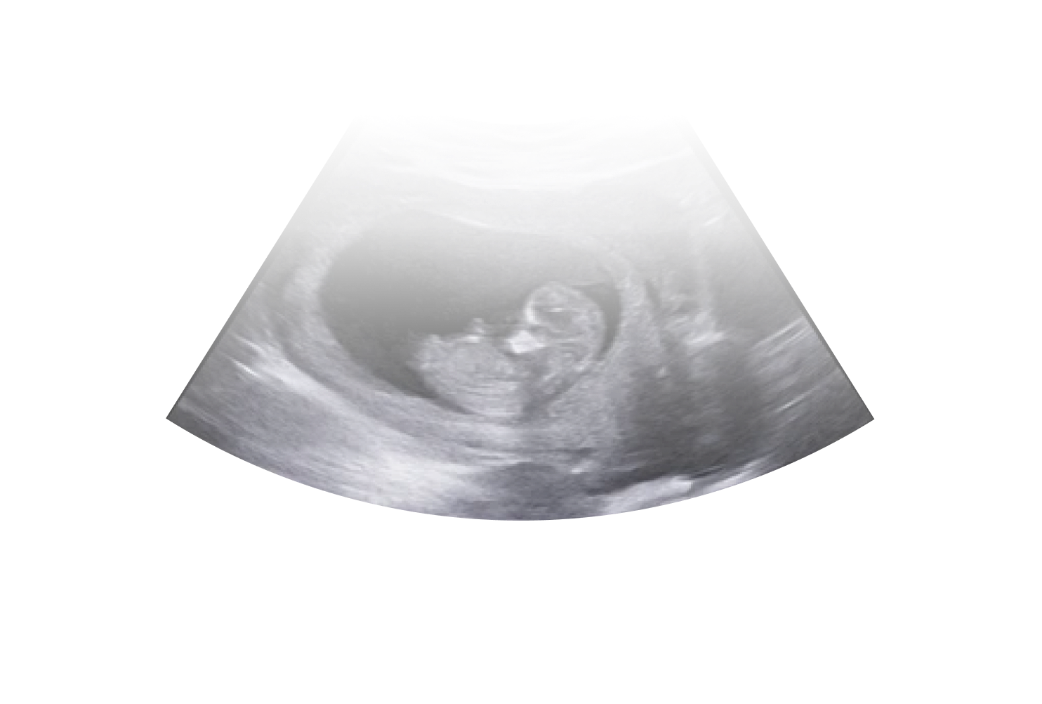 Pregnancy Insights