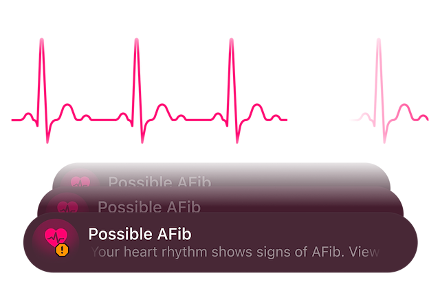 AFib Detection