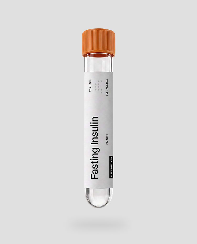 Fasting Insulin (At-Lab)