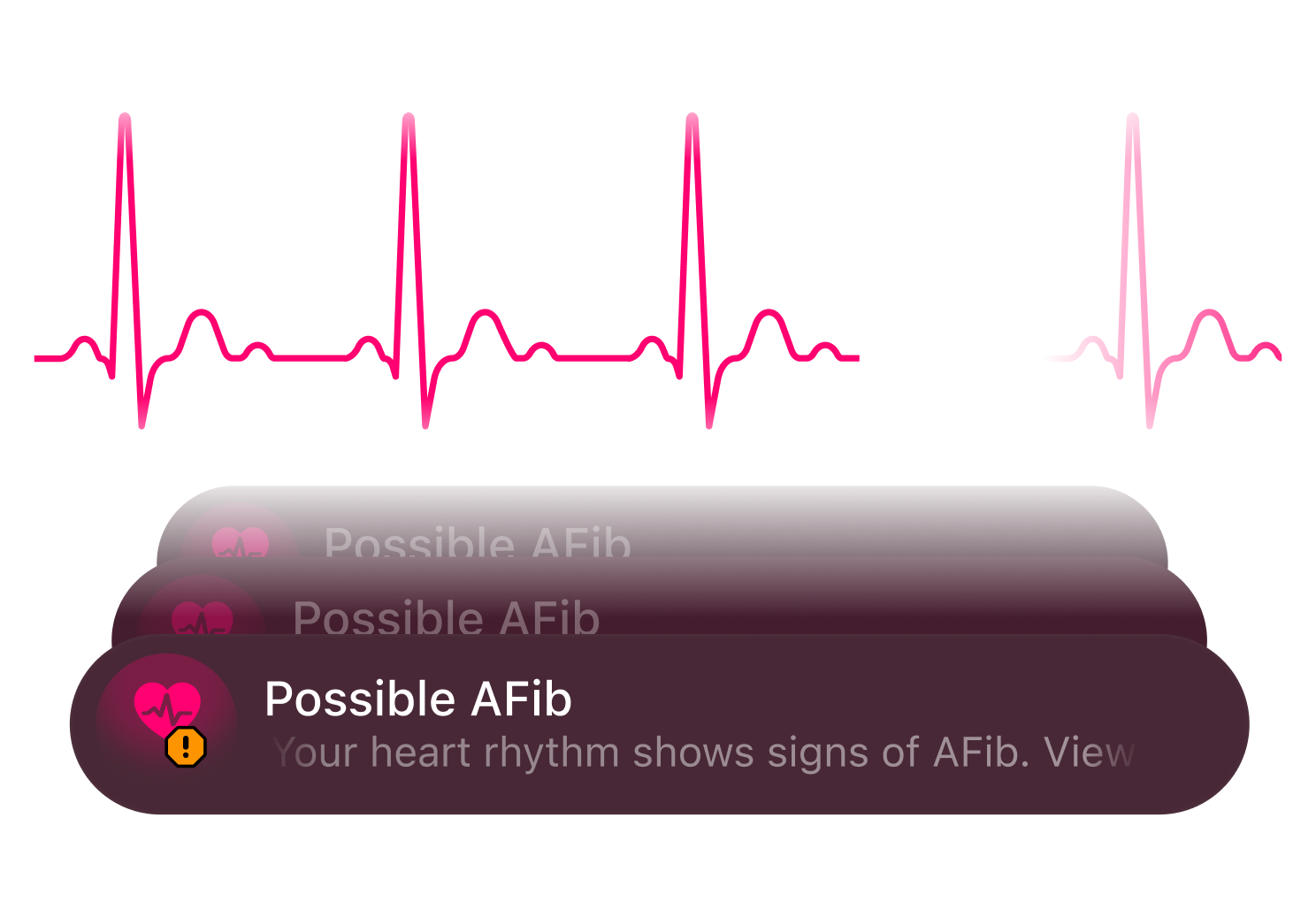 AFib Detection