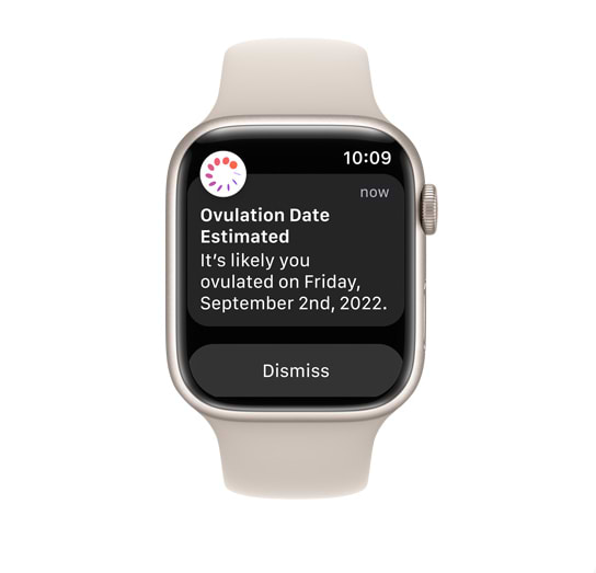 שעון חכם Apple Watch Series 8 GPS 41mm Aluminum Case - צבע שחור חצות שנה אחריות ע