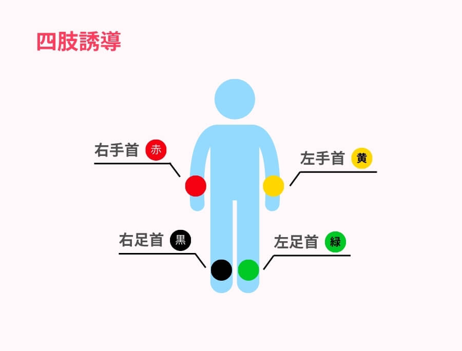 四肢誘導の電極の貼り方