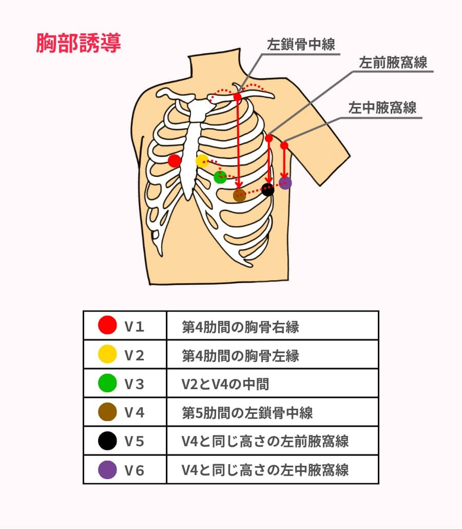 胸部誘導の電極の貼り方