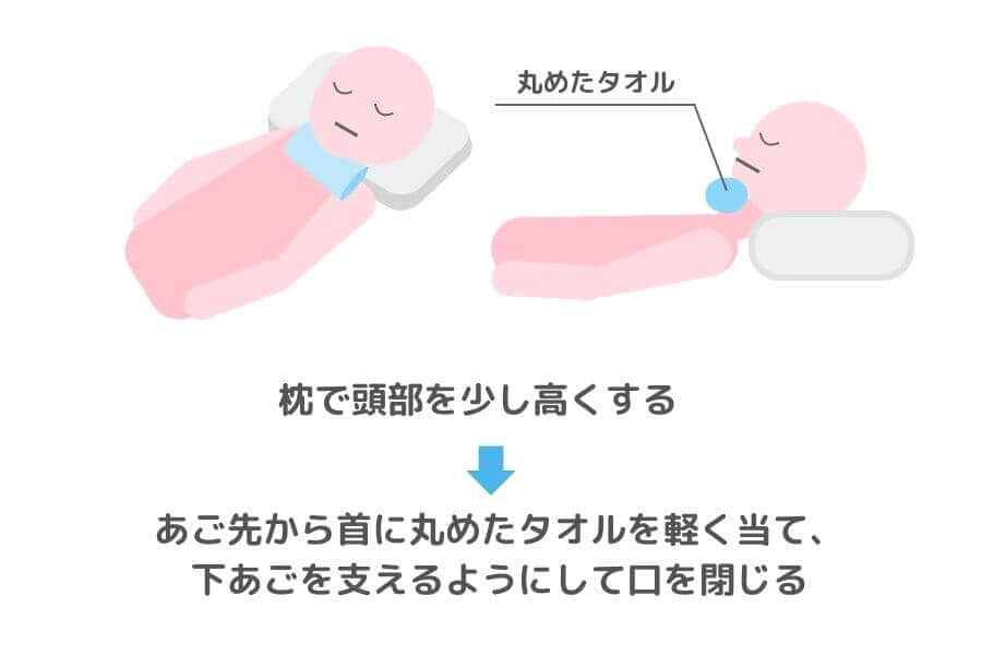 エンゼルケアで口を閉じる時のポイント