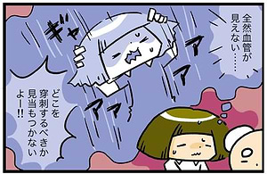 見えにくい血管の対応