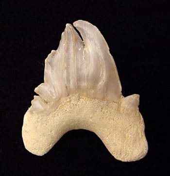 Pathologic teeth