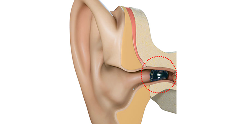 「ヒアラブル」が切り開くユニバーサルなコミュニケーション