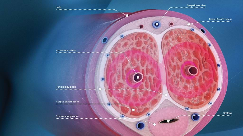 Anatomical incision of the penis