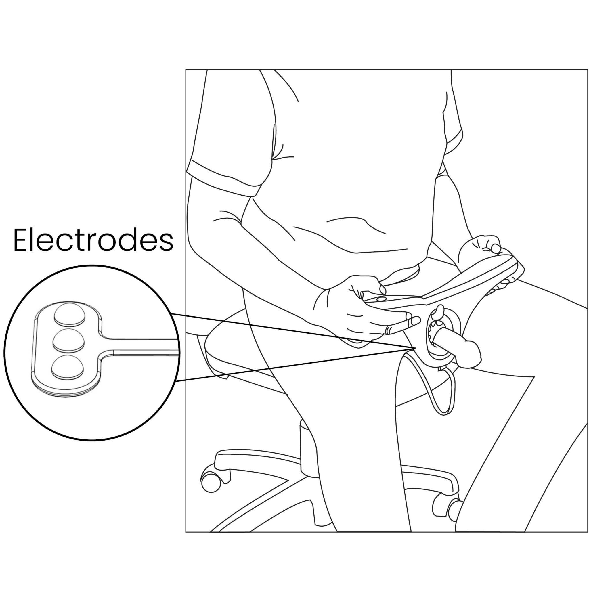 Step two - Treatment by Vertica®